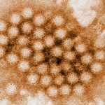 norovirus 
